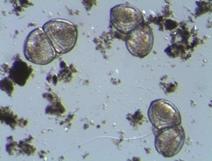 Unio crassus larvae (ca. 0,08 mm)