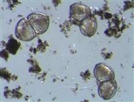 Unio crassus Larven (ca. 0,2 mm)